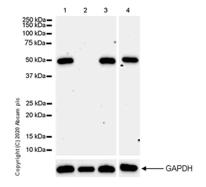 Western blot - Anti-SET7 antibody [EPR23775-142] (AB274416), expandable thumbnail