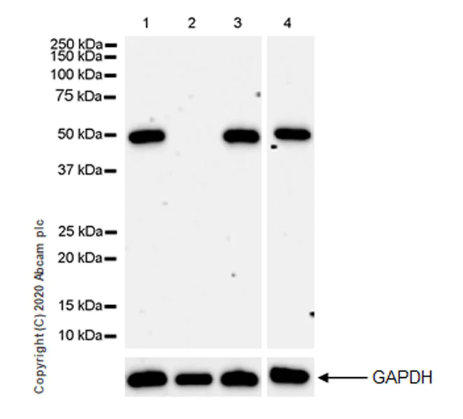 Western blot - Anti-SET7 antibody [EPR23775-142] (AB274416)