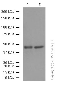 Western blot - Anti-SET7 antibody [EPR5574] (AB124708), expandable thumbnail