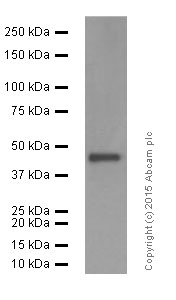 Western blot - Anti-SET7 antibody [EPR5574] (AB124708), expandable thumbnail
