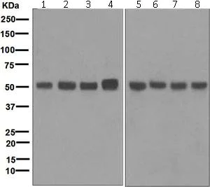 Western blot - Anti-SET7 antibody [EPR5574] (AB124708)