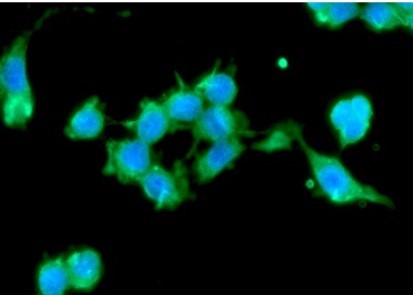 Immunocytochemistry/ Immunofluorescence - Anti-SET7 antibody [s4E5] (AB14820)