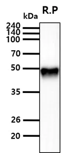 Western blot - Anti-SET7 antibody [s4E5] (AB14820)