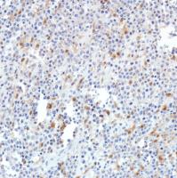 Immunohistochemistry (Formalin/PFA-fixed paraffin-embedded sections) - Anti-SETBP1 antibody [SP312] (AB216603), expandable thumbnail