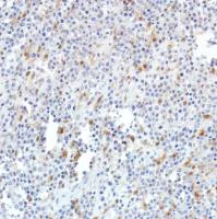 Immunohistochemistry (Formalin/PFA-fixed paraffin-embedded sections) - Anti-SETBP1 antibody [SP312] (AB216603)