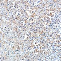 Immunohistochemistry (Formalin/PFA-fixed paraffin-embedded sections) - Anti-SETBP1 antibody [SP312] (AB216603), expandable thumbnail