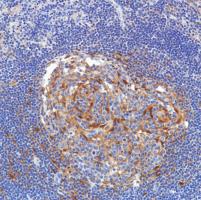 Immunohistochemistry (Formalin/PFA-fixed paraffin-embedded sections) - Anti-SETBP1 antibody [SP312] (AB216603), expandable thumbnail