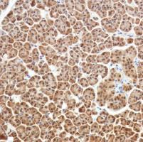 Immunohistochemistry (Formalin/PFA-fixed paraffin-embedded sections) - Anti-SETBP1 antibody [SP312] (AB216603), expandable thumbnail
