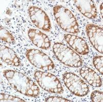 Immunohistochemistry (Formalin/PFA-fixed paraffin-embedded sections) - Anti-SETBP1 antibody [SP312] (ab216603), expandable thumbnail