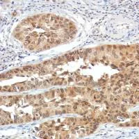 Immunohistochemistry (Formalin/PFA-fixed paraffin-embedded sections) - Anti-SETBP1 antibody [SP312] (AB216603)