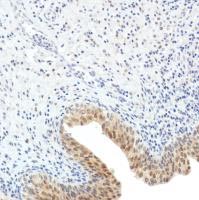 Immunohistochemistry (Formalin/PFA-fixed paraffin-embedded sections) - Anti-SETBP1 antibody [SP312] (ab216603), expandable thumbnail