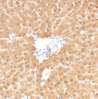 Immunohistochemistry (Formalin/PFA-fixed paraffin-embedded sections) - Anti-SETBP1 antibody [SP312] (AB216603), expandable thumbnail
