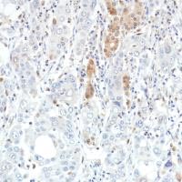 Immunohistochemistry (Formalin/PFA-fixed paraffin-embedded sections) - Anti-SETBP1 antibody [SP312] (ab216603), expandable thumbnail