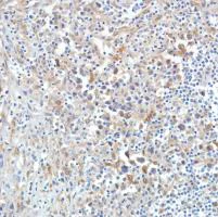 Immunohistochemistry (Formalin/PFA-fixed paraffin-embedded sections) - Anti-SETBP1 antibody [SP312] - BSA and Azide free (AB272000)