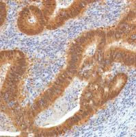 Immunohistochemistry (Formalin/PFA-fixed paraffin-embedded sections) - Anti-SETBP1 antibody [SP312] - BSA and Azide free (AB272000)