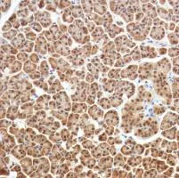 Immunohistochemistry (Formalin/PFA-fixed paraffin-embedded sections) - Anti-SETBP1 antibody [SP312] - BSA and Azide free (AB272000)