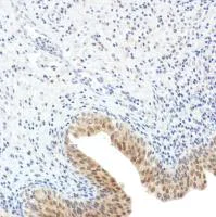 Immunohistochemistry (Formalin/PFA-fixed paraffin-embedded sections) - Anti-SETBP1 antibody [SP312] - BSA and Azide free (AB272000)
