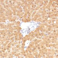 Immunohistochemistry (Formalin/PFA-fixed paraffin-embedded sections) - Anti-SETBP1 antibody [SP312] - BSA and Azide free (AB272000)