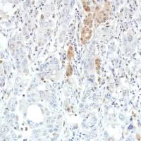 Immunohistochemistry (Formalin/PFA-fixed paraffin-embedded sections) - Anti-SETBP1 antibody [SP312] - BSA and Azide free (AB272000)