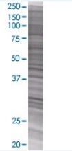 SETBP1 overexpression 293T lysate (whole cell)