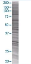 SDS-PAGE - SETBP1 overexpression 293T lysate (whole cell) (AB94171)