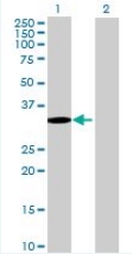 Western blot - SETBP1 overexpression 293T lysate (whole cell) (AB94171)