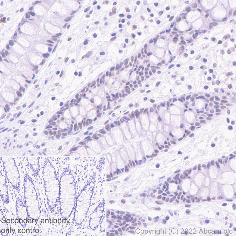 Immunohistochemistry (Formalin/PFA-fixed paraffin-embedded sections) - Anti-SETD1B antibody [EPR25142-11] (AB300479)