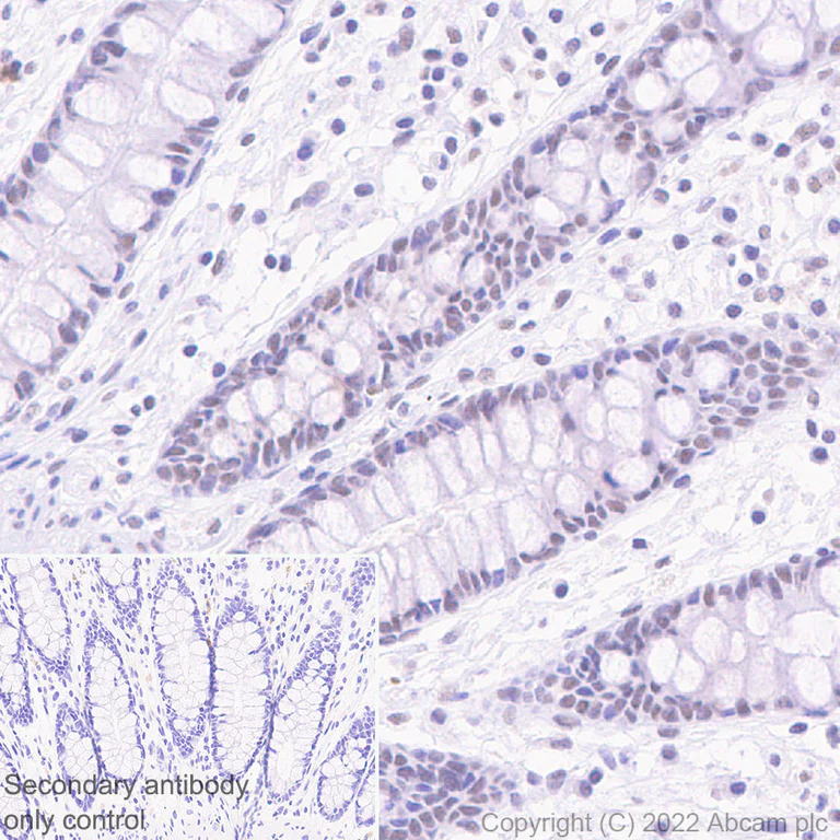 Immunohistochemistry (Formalin/PFA-fixed paraffin-embedded sections) - Anti-SETD1B antibody [EPR25142-11] (BSA and Azide free) (AB300480)