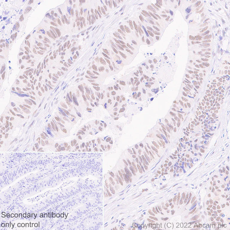 Immunohistochemistry (Formalin/PFA-fixed paraffin-embedded sections) - Anti-SETD1B antibody [EPR25142-11] (BSA and Azide free) (AB300480)