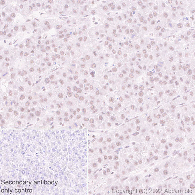 Immunohistochemistry (Formalin/PFA-fixed paraffin-embedded sections) - Anti-SETD1B antibody [EPR25142-11] (BSA and Azide free) (AB300480)