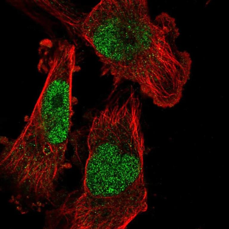 Immunocytochemistry/ Immunofluorescence - Anti-SETDB1 Antibody (AB327247)