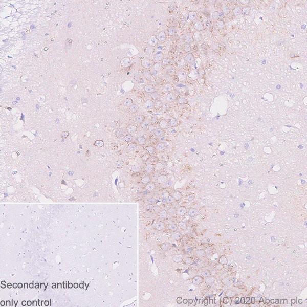 Immunohistochemistry (Formalin/PFA-fixed paraffin-embedded sections) - Anti-Sez6 antibody [14E5] - BSA and Azide free (AB255859), expandable thumbnail