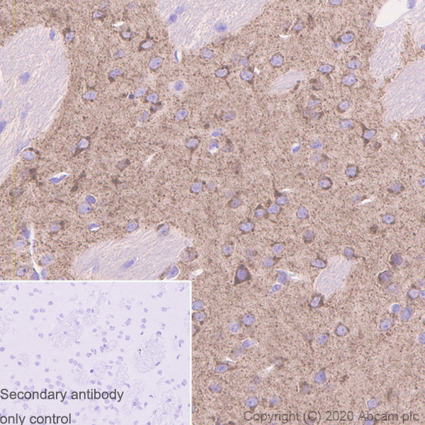 Immunohistochemistry (Formalin/PFA-fixed paraffin-embedded sections) - Anti-Sez6 antibody [14E5] - BSA and Azide free (AB255859), expandable thumbnail