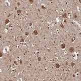 Immunohistochemistry (Formalin/PFA-fixed paraffin-embedded sections) - Anti-Sez6 antibody (AB121347)