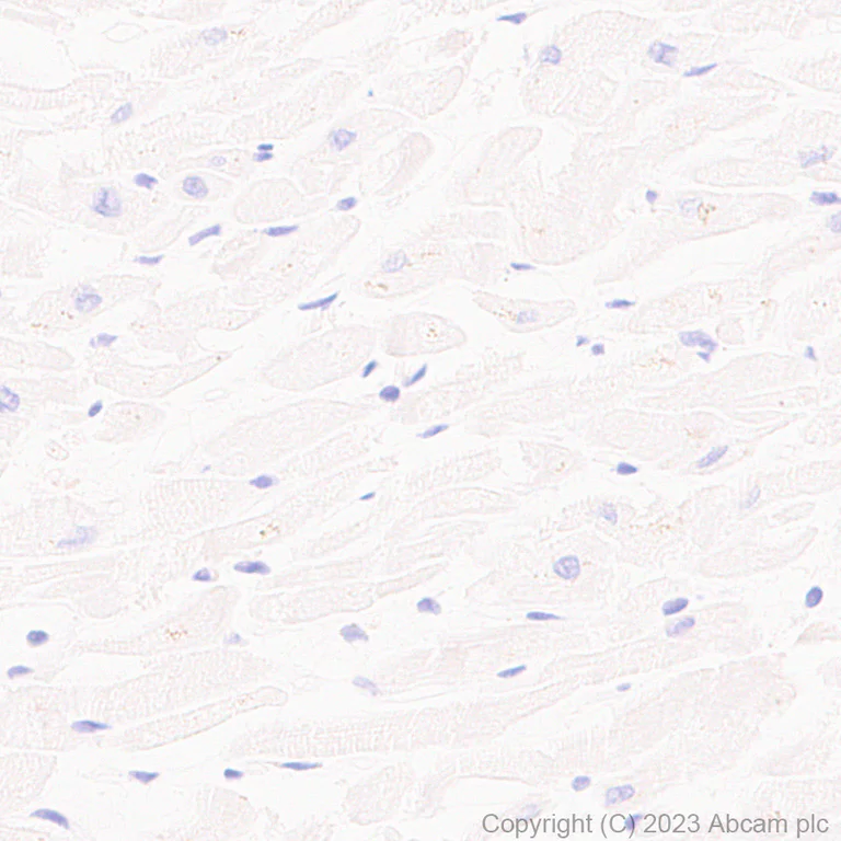 Immunohistochemistry (Formalin/PFA-fixed paraffin-embedded sections) - Anti-Sez6 antibody [EPR28518-55] (AB314233)