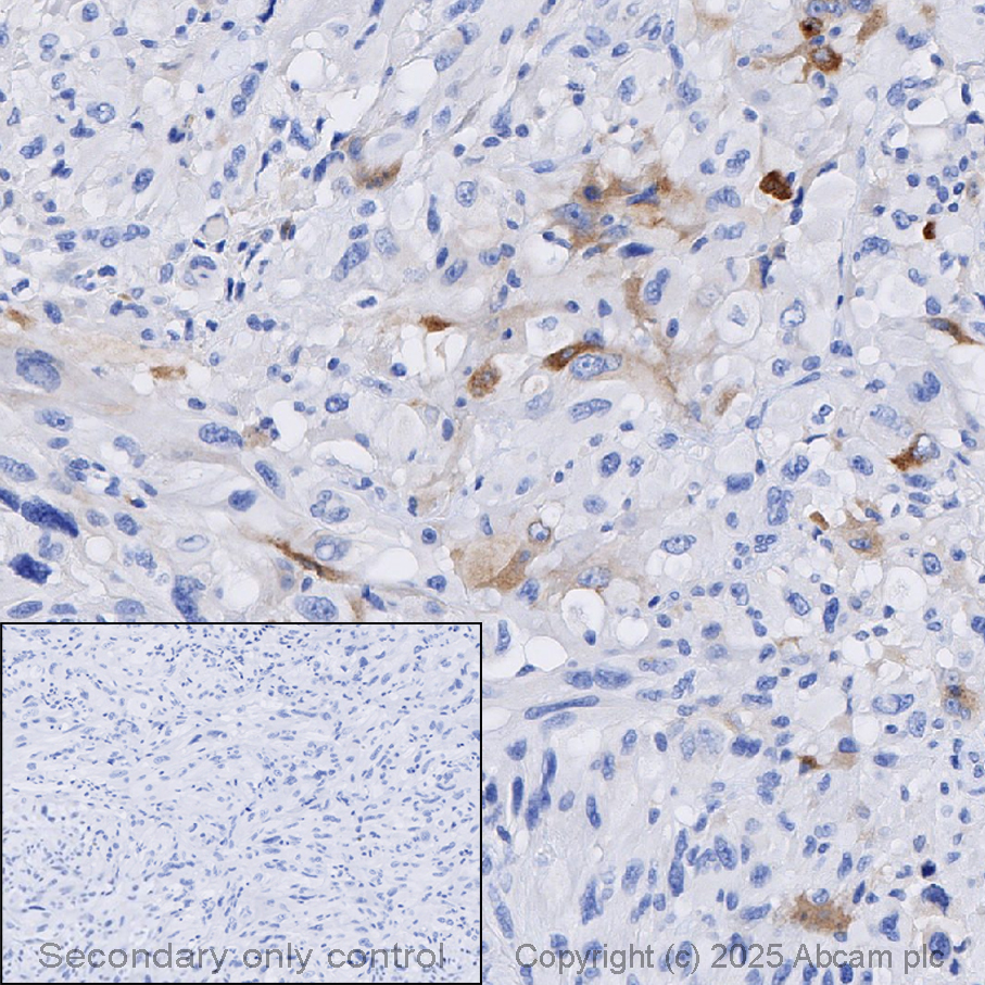 Immunohistochemistry (Formalin/PFA-fixed paraffin-embedded sections) - Anti-Sez6 antibody [EPR28518-55] (AB314233)