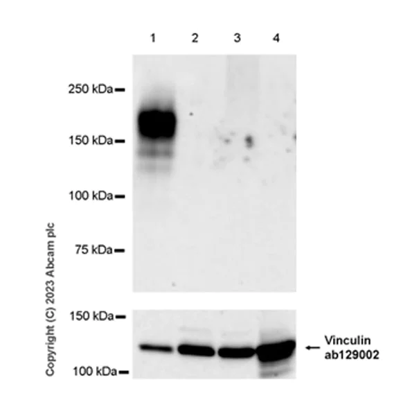 Western blot - Anti-Sez6 antibody [EPR28518-55] (AB314233)