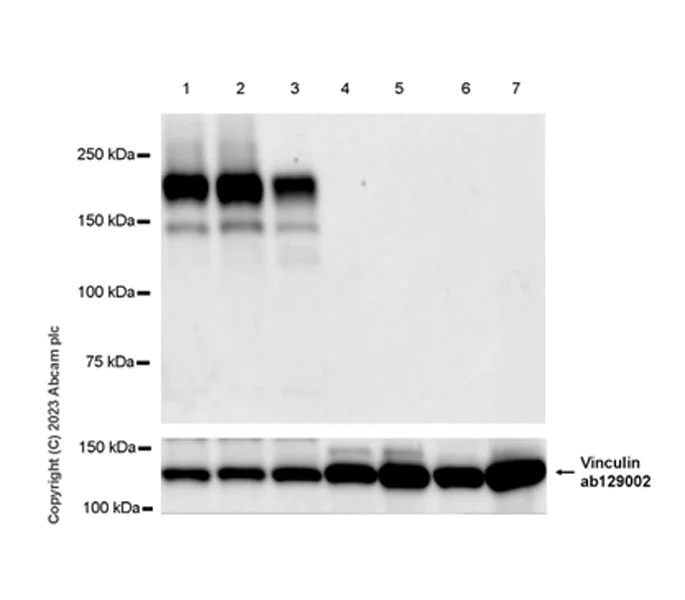 Western blot - Anti-Sez6 antibody [EPR28518-55] (AB314233)