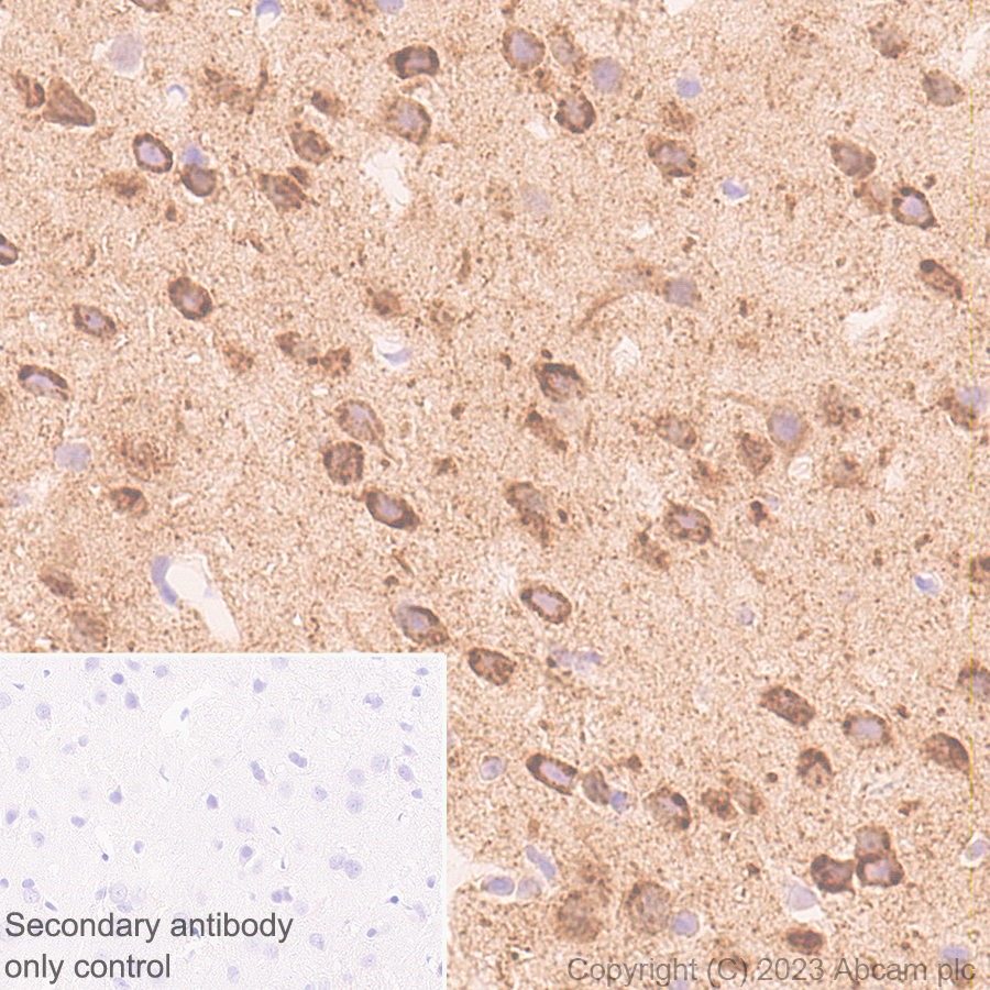 Immunohistochemistry (Formalin/PFA-fixed paraffin-embedded sections) - Anti-Sez6 antibody [EPR28518-55] - BSA and Azide free (ab314234), expandable thumbnail
