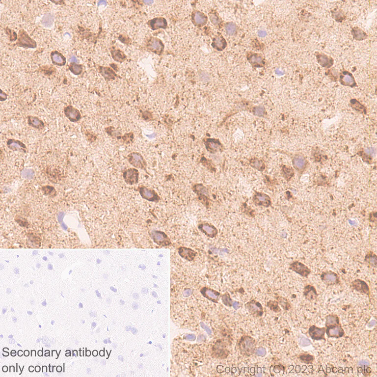 Immunohistochemistry (Formalin/PFA-fixed paraffin-embedded sections) - Anti-Sez6 antibody [EPR28518-55] - BSA and Azide free (AB314234)