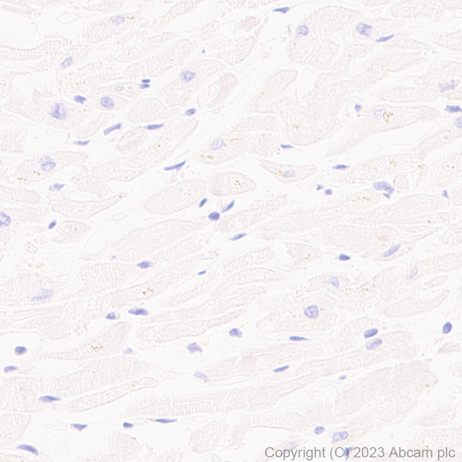 Immunohistochemistry (Formalin/PFA-fixed paraffin-embedded sections) - Anti-Sez6 antibody [EPR28518-55] - BSA and Azide free (ab314234), expandable thumbnail