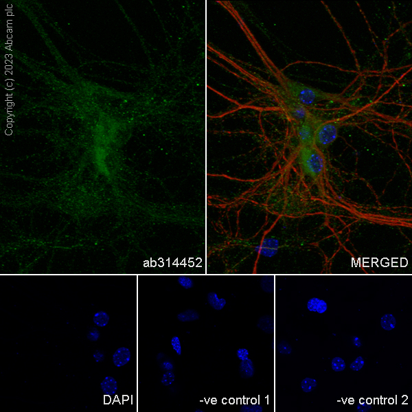 Immunocytochemistry/ Immunofluorescence - Anti-Sez6 antibody [EPR28518-83] - BSA and Azide free (AB314453), expandable thumbnail
