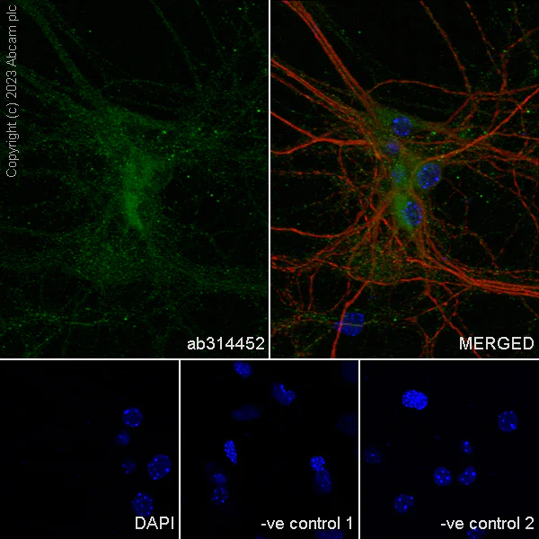 Immunocytochemistry/ Immunofluorescence - Anti-Sez6 antibody [EPR28518-83] - BSA and Azide free (AB314453)
