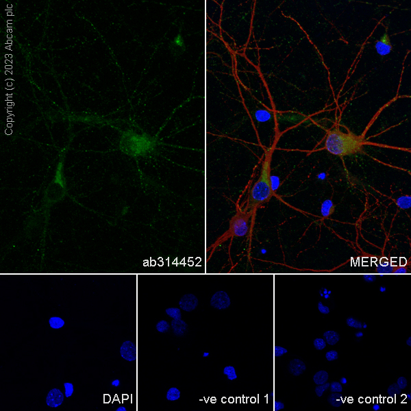 Immunocytochemistry/ Immunofluorescence - Anti-Sez6 antibody [EPR28518-83] - BSA and Azide free (AB314453), expandable thumbnail