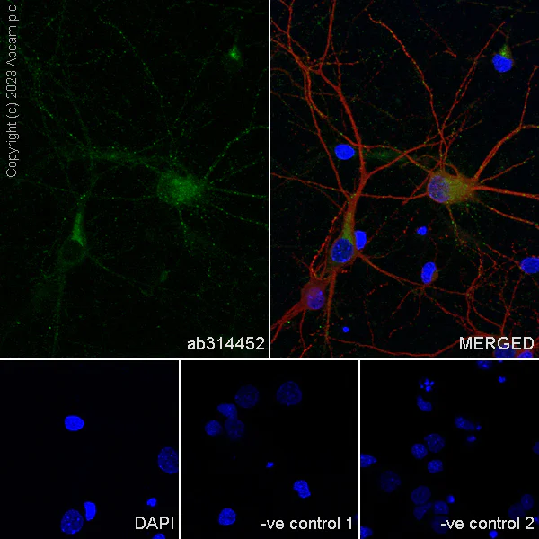 Immunocytochemistry/ Immunofluorescence - Anti-Sez6 antibody [EPR28518-83] - BSA and Azide free (AB314453)