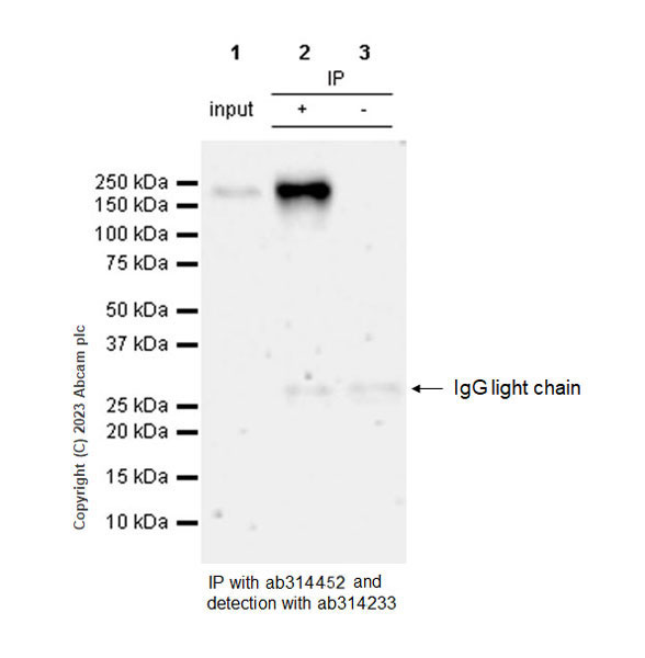 Immunoprecipitation - Anti-Sez6 antibody [EPR28518-83] - BSA and Azide free (ab314453), expandable thumbnail