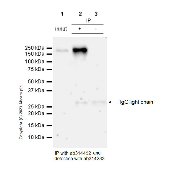 Immunoprecipitation - Anti-Sez6 antibody [EPR28518-83] - BSA and Azide free (AB314453)