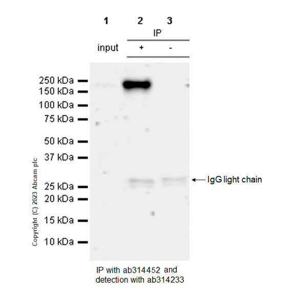 Immunoprecipitation - Anti-Sez6 antibody [EPR28518-83] - BSA and Azide free (AB314453), expandable thumbnail