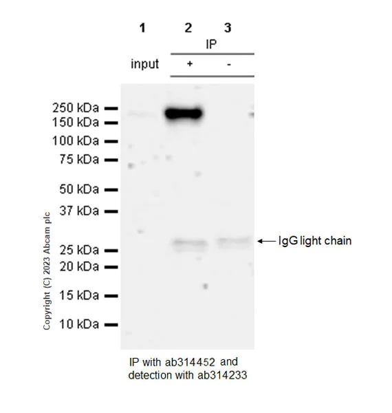 Immunoprecipitation - Anti-Sez6 antibody [EPR28518-83] - BSA and Azide free (AB314453)