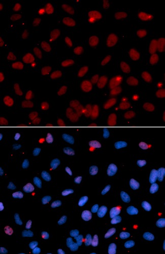 Immunocytochemistry/ Immunofluorescence - Anti-SF2 antibody (AB238523), expandable thumbnail